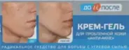 До и После Анти-акне крем для проблемной кожи