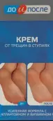 До и После крем д/ног от трещин Туба 150мл от АММА