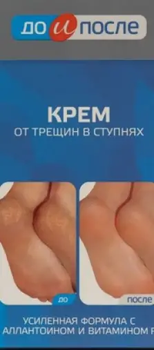 До и После крем д/ног от трещин Туба 150мл произодства Твинс Тэк ЗАО