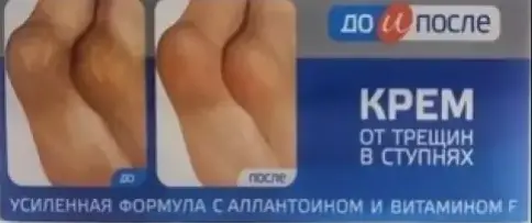 До и После крем д/ног от трещин Туба 50мл