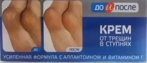 До и После крем д/ног от трещин Туба 50мл произодства Твинс Тэк ЗАО