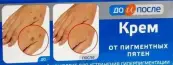До и После крем от пигментных пятен Туба 50мл от ПроБио